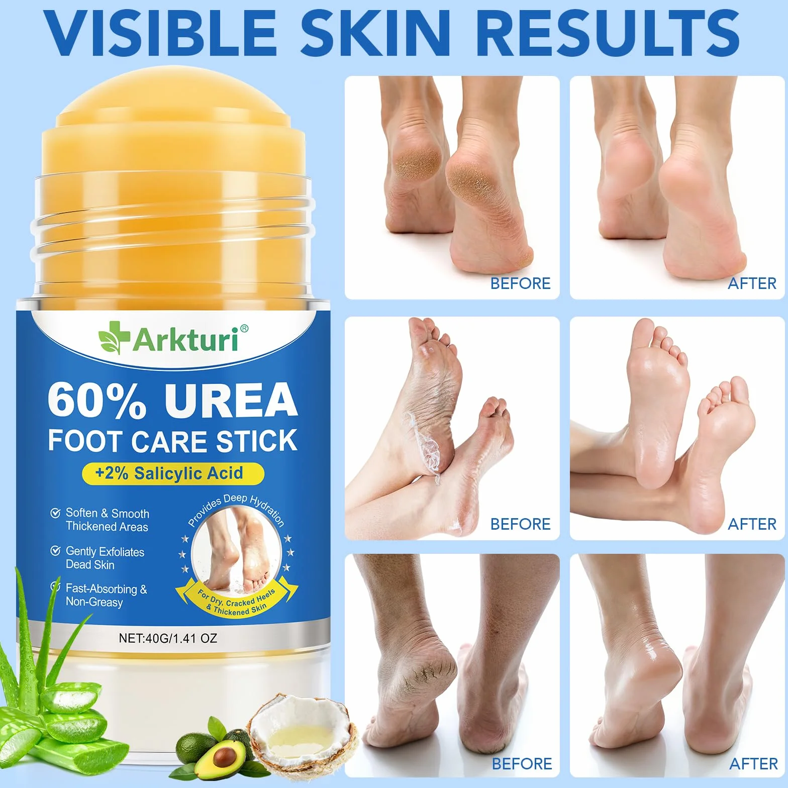 Crema de Urea para Pies 80g 60% Reparador Intensivo para Talones Agrietados