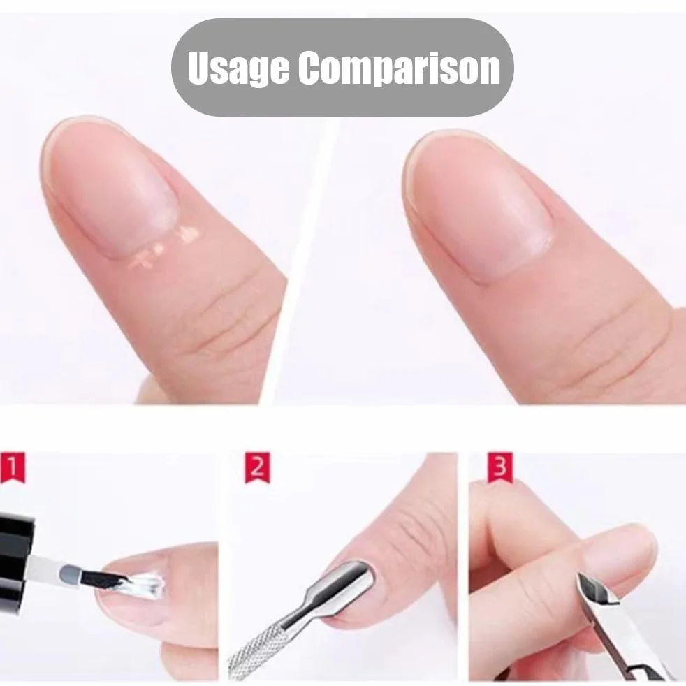 2 Piece Cuticle Nipper and Cuticle Pusher Set, Stainless Steel Cuticle Nippers/Nail Clippers/Trimmers and Scissors for Fingernail/Toenail Trimming
