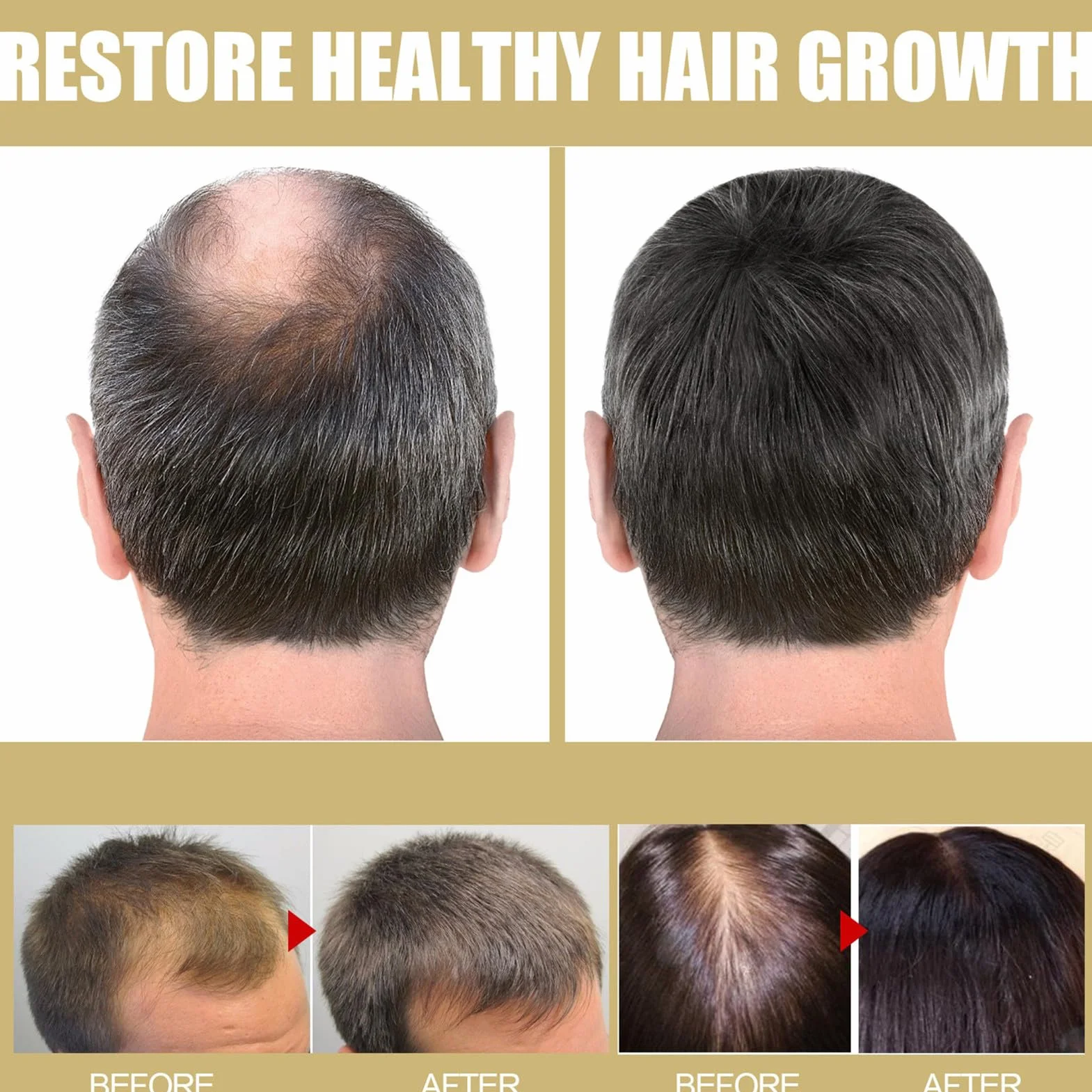 Sombrero para el crecimiento del cabello por infrarrojos contra el adelgazamiento