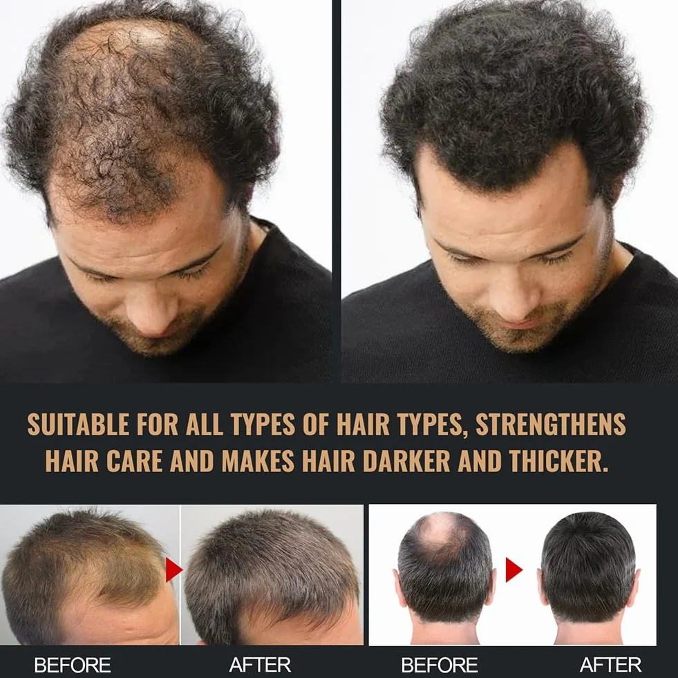 Champú activador de raíz para hombres pérdida de cabello espesor repara suaviza fortalece