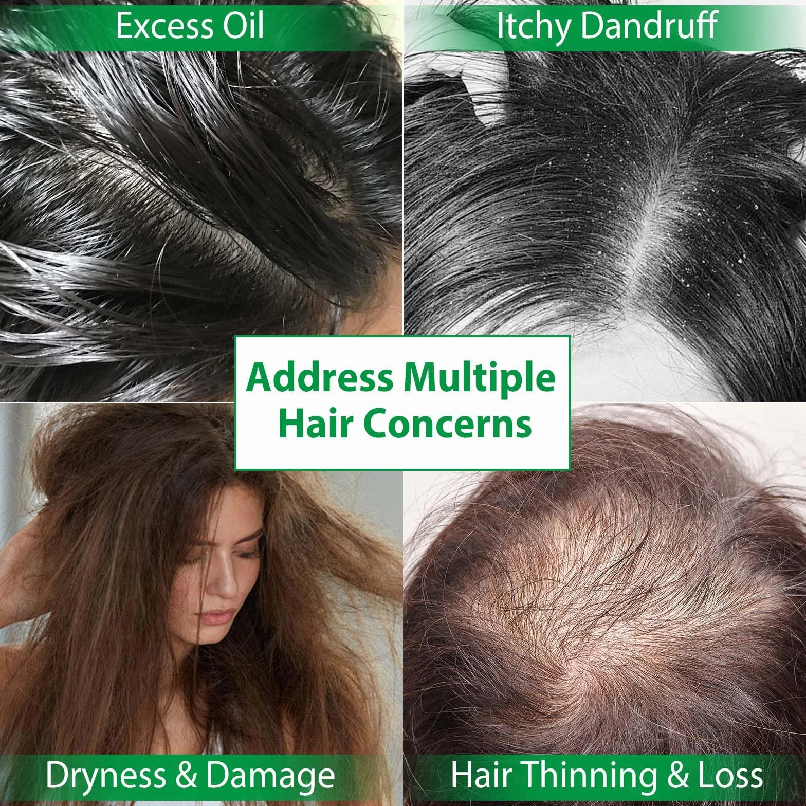 Batana Champú y Acondicionador para el Crecimiento del Cabello - Anti-caída para Cabello Delgado