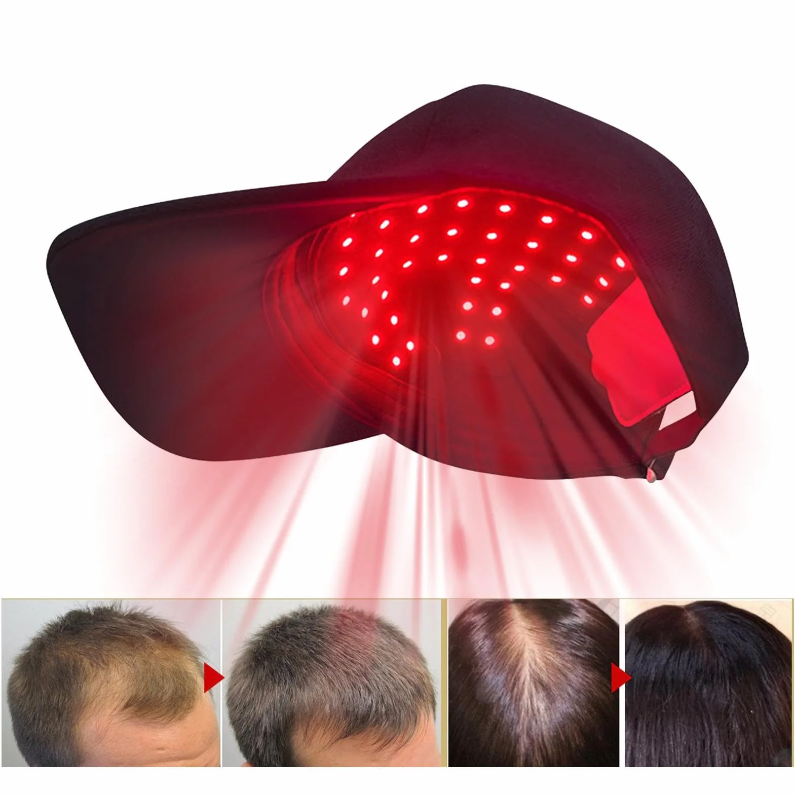 Gorra LED crecimiento cabello infrarroja recargable inalámbrica 450nm 660nm 850nm negro