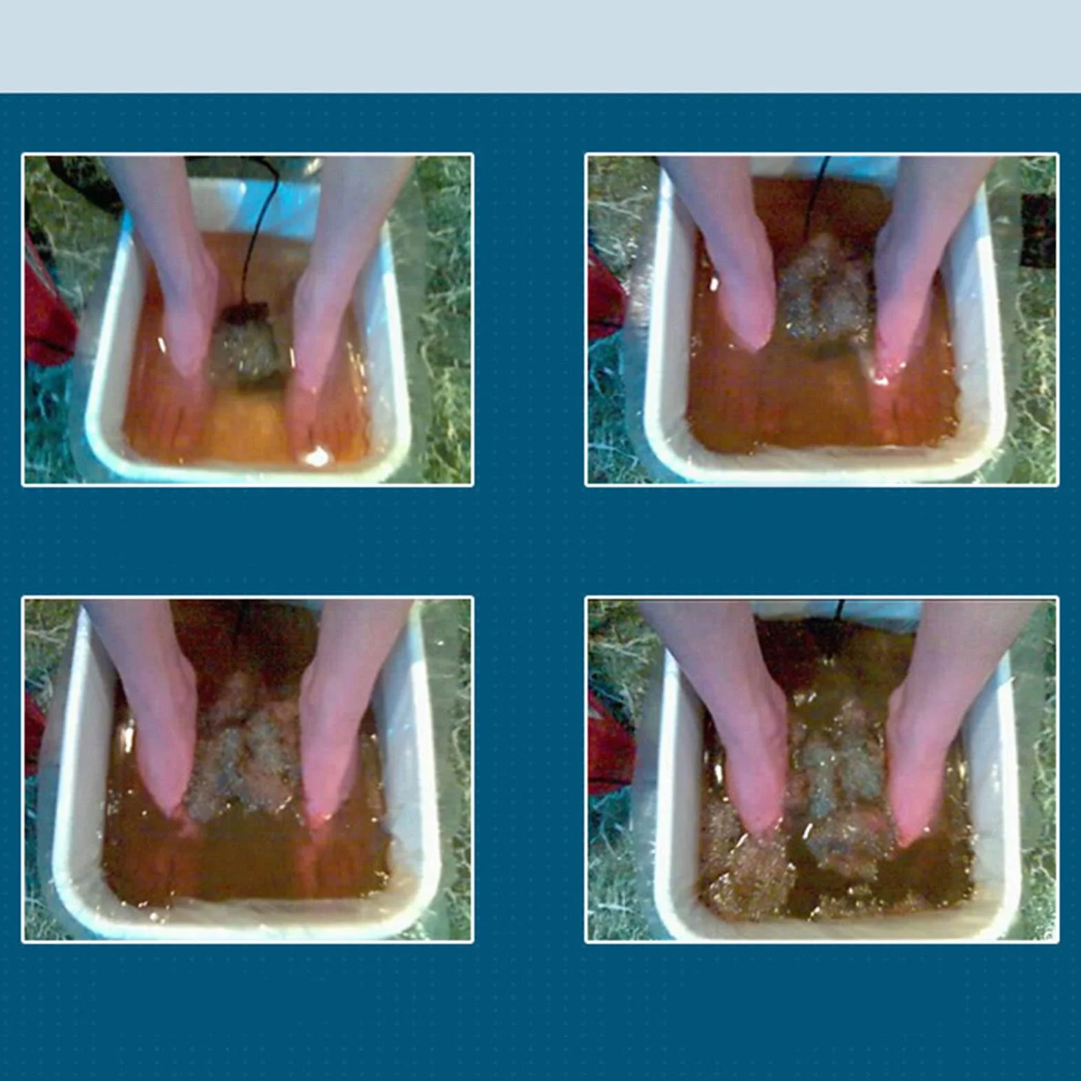 Matriz De Desintoxicación De Baño De Pies Iónicos, Acero Inoxidable 10 Accesorio