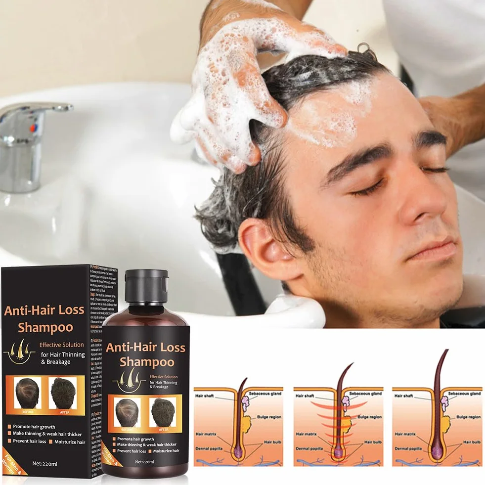 Champu Crecimiento Cabello Antipérdida Tratamiento 220ml