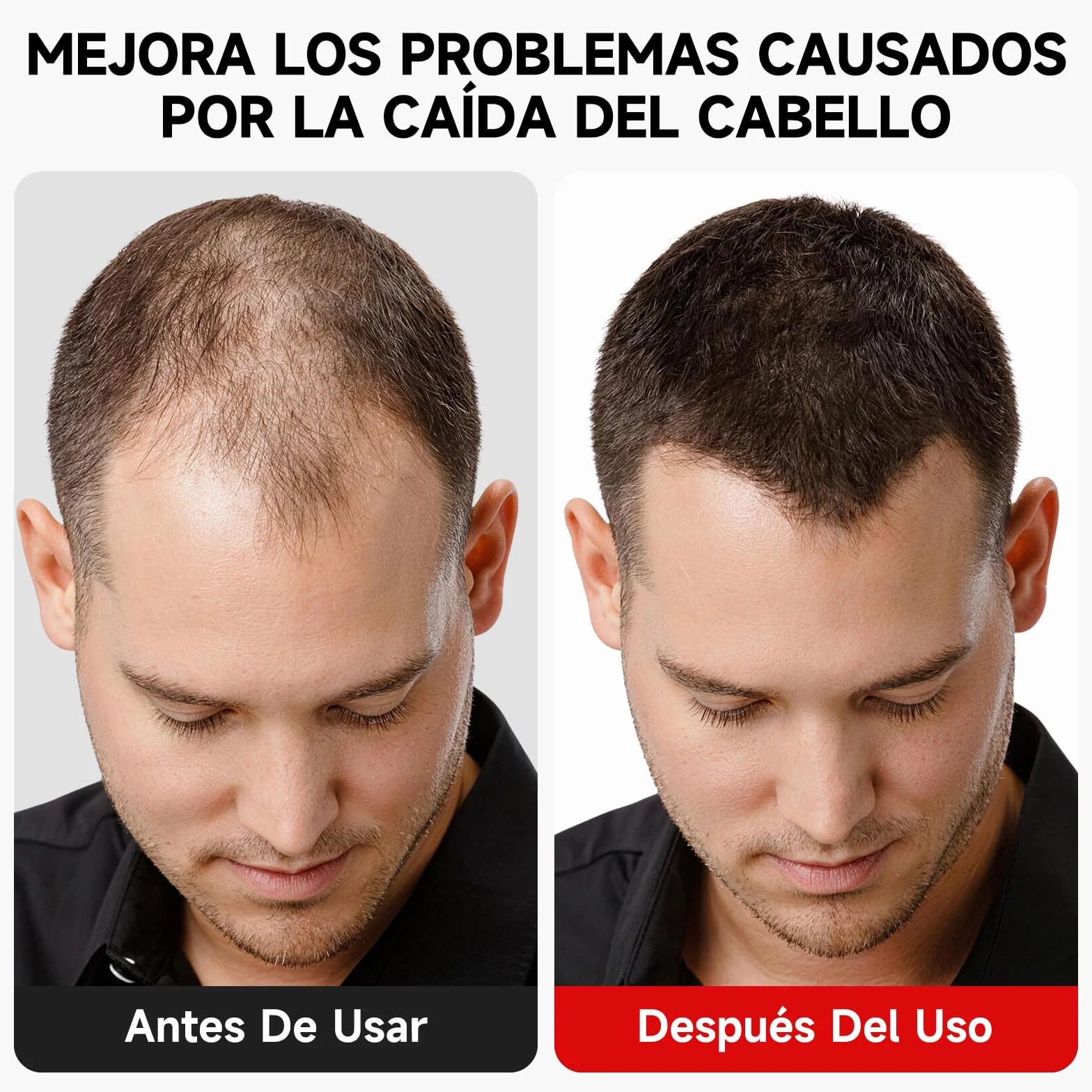 Gorra para Crecimiento del Cabello 660 nm 850 nm 7 Modos Dispositivo Láser