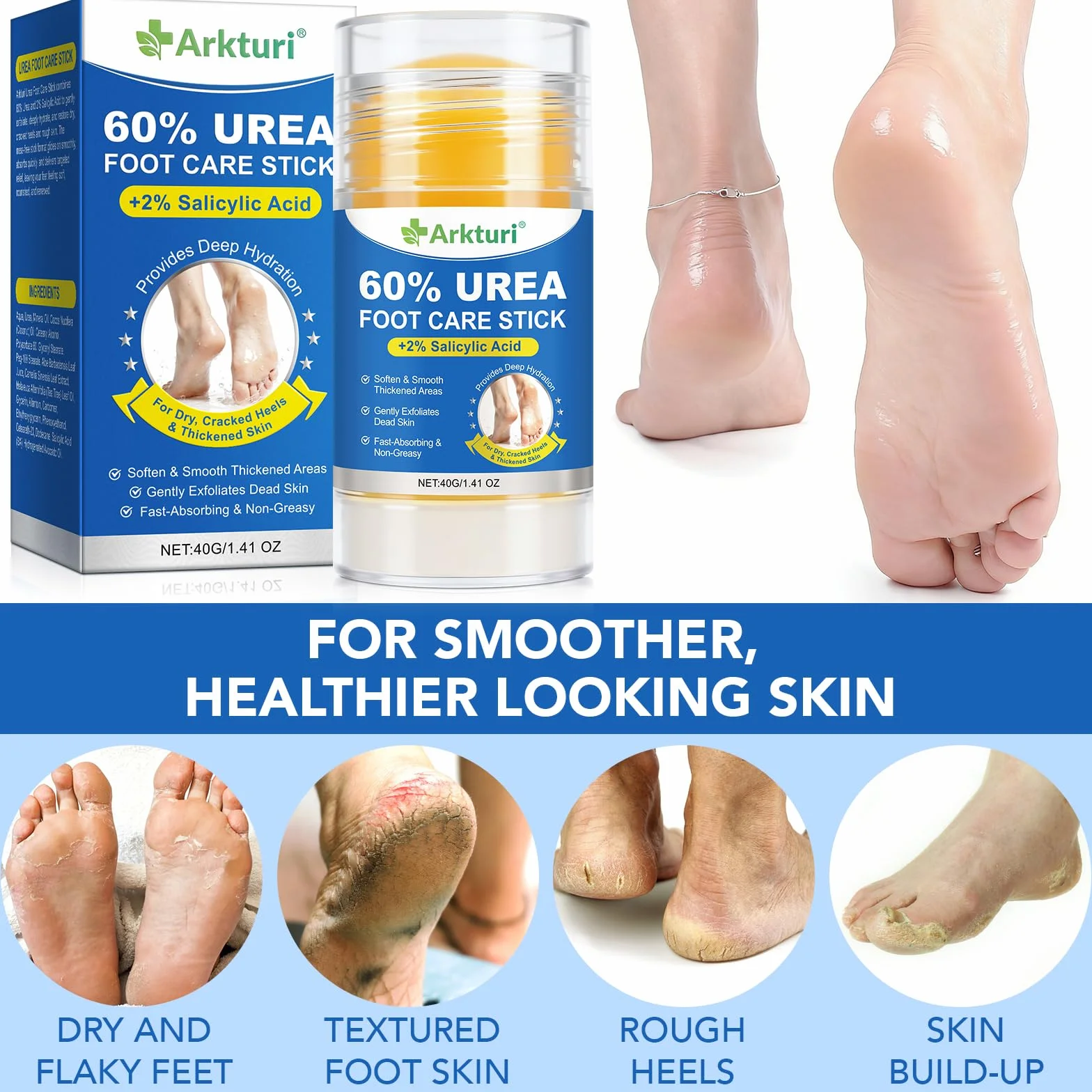 Crema de Urea para Pies 80g 60% Reparador Intensivo para Talones Agrietados
