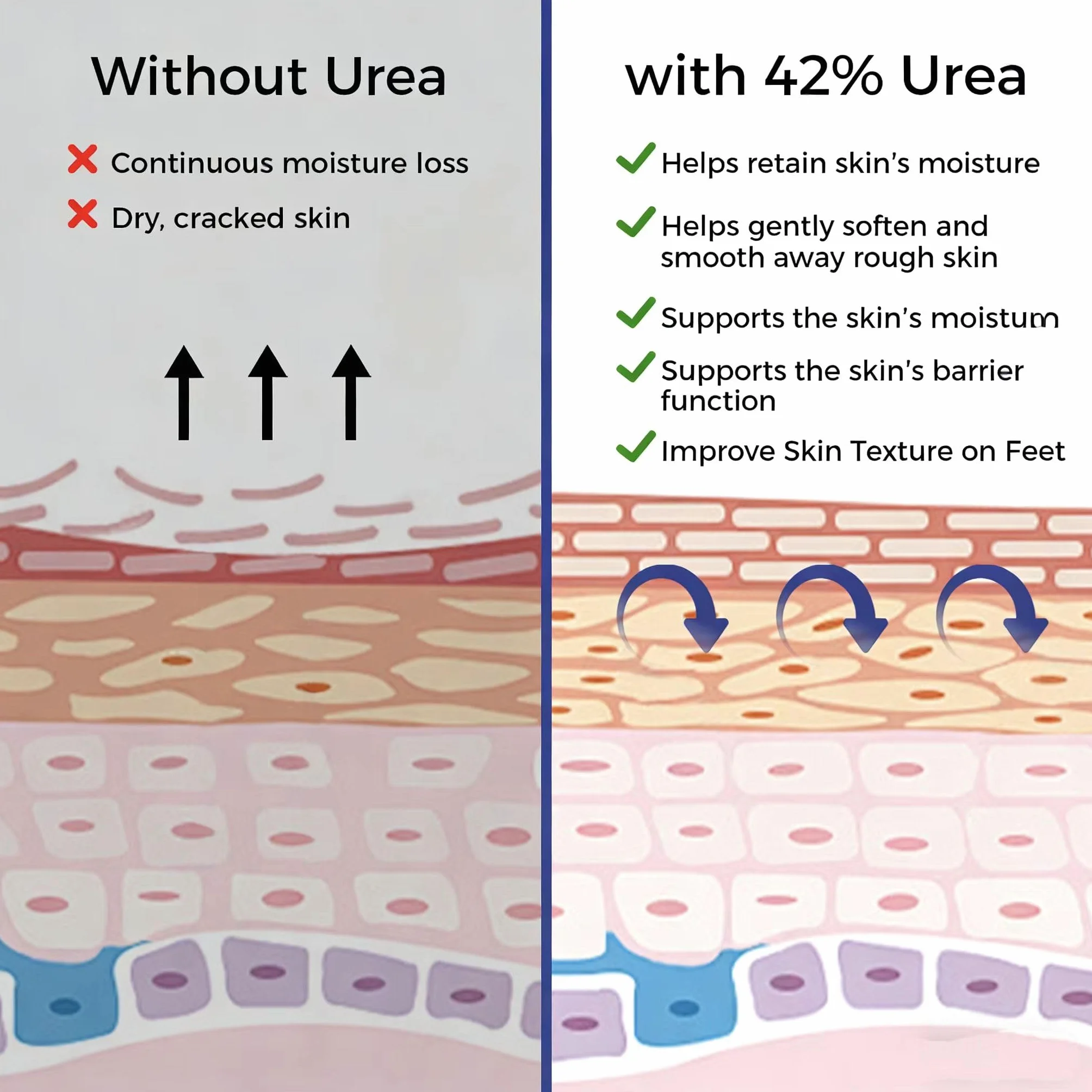 OUKEYA Crema Urea 42% con Ácido Salicílico 2% Tratamiento Intensivo para Piel Agrietada Talones y Codos Elimina Callos Antifisuras