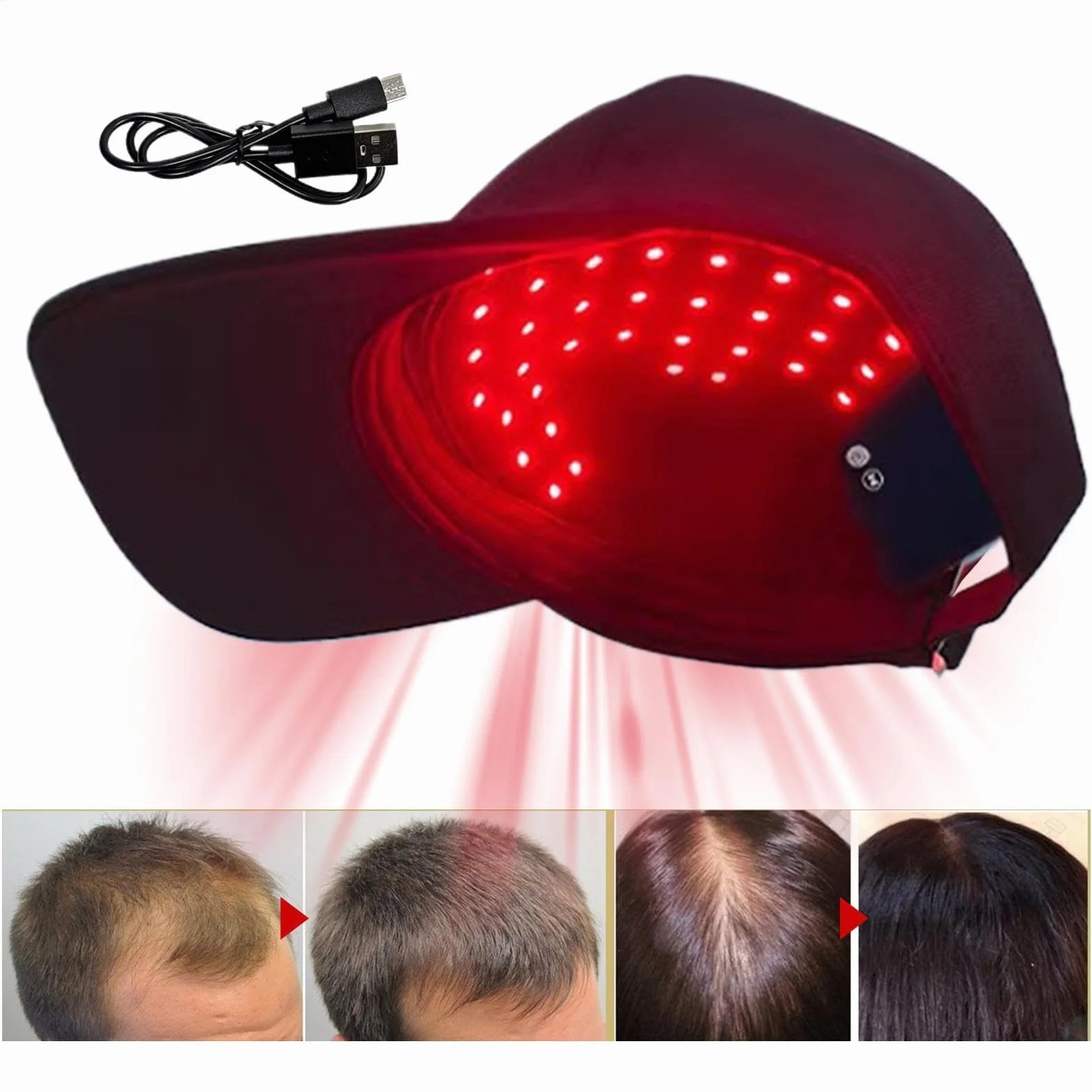 Gorra LED crecimiento cabello 450nm 660nm estimulador cuero cabelludo luz roja portátil