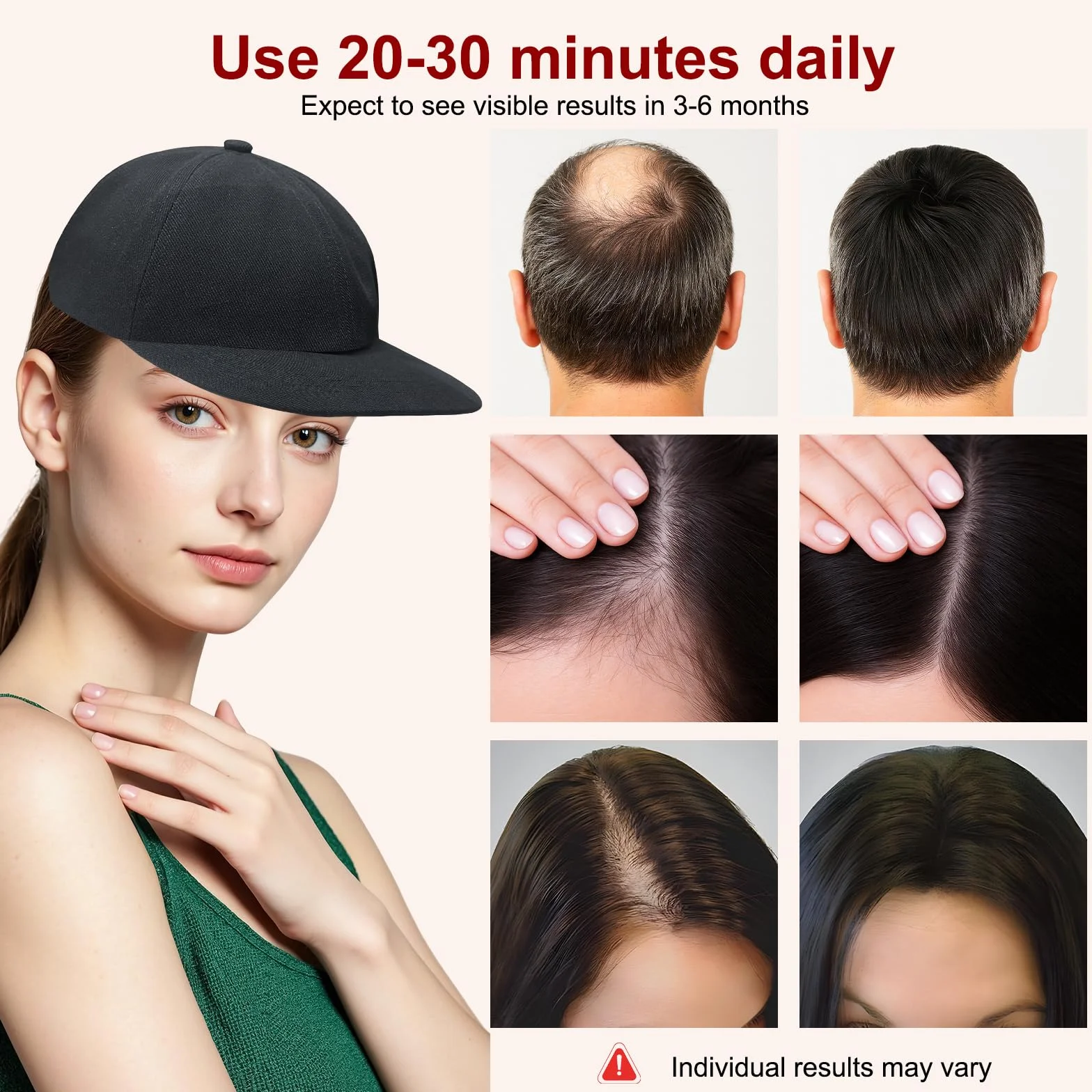 Gorra láser LLLT para crecimiento del cabello – Luz roja e infrarroja 660/850/940 nm, 5 niveles, temporizador