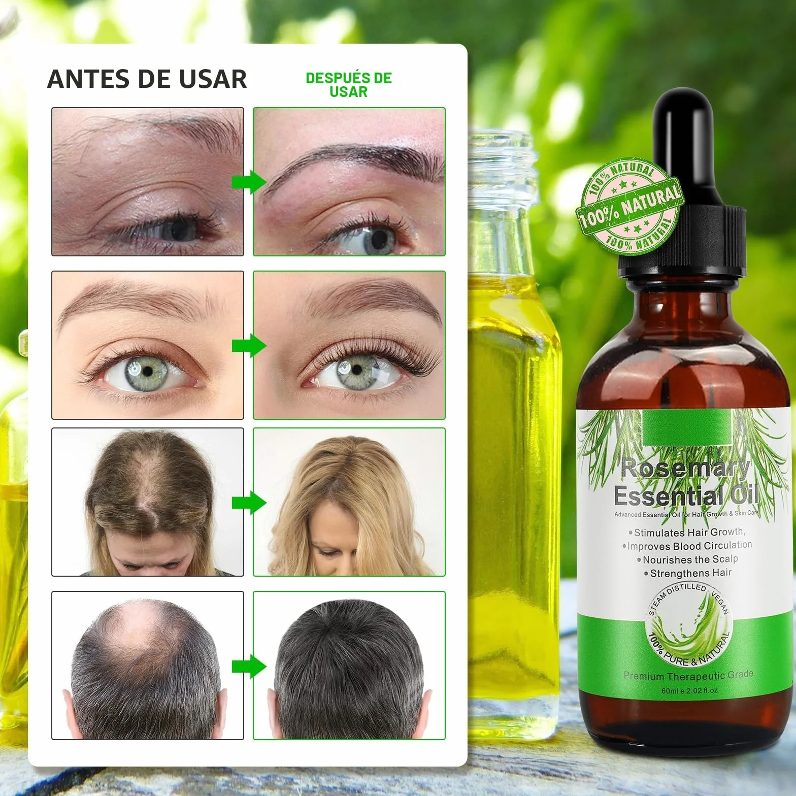 Aceite de Romero 100% puro para Crecimiento del Cabello 60ml con Masajeador de Cuero Cabelludo