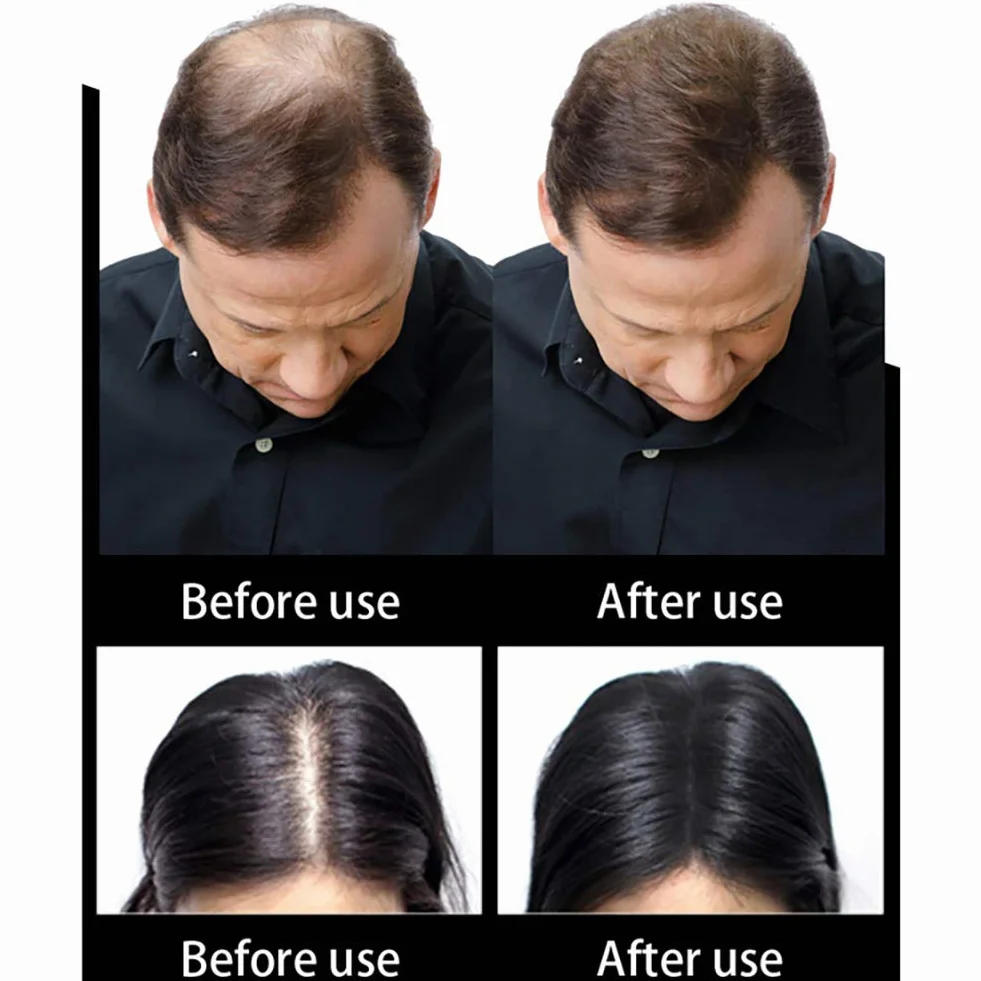 Fibras de Cabello Naturales para Cabello Fino y Escaso, Efecto Inmediato (Marron oscuro)