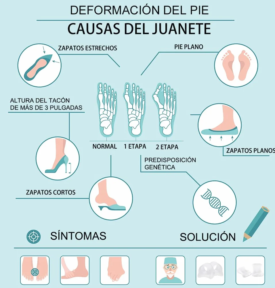 Separadores de dedos de gel 12 unidades corrector juanetes martillo dedos superpuestos