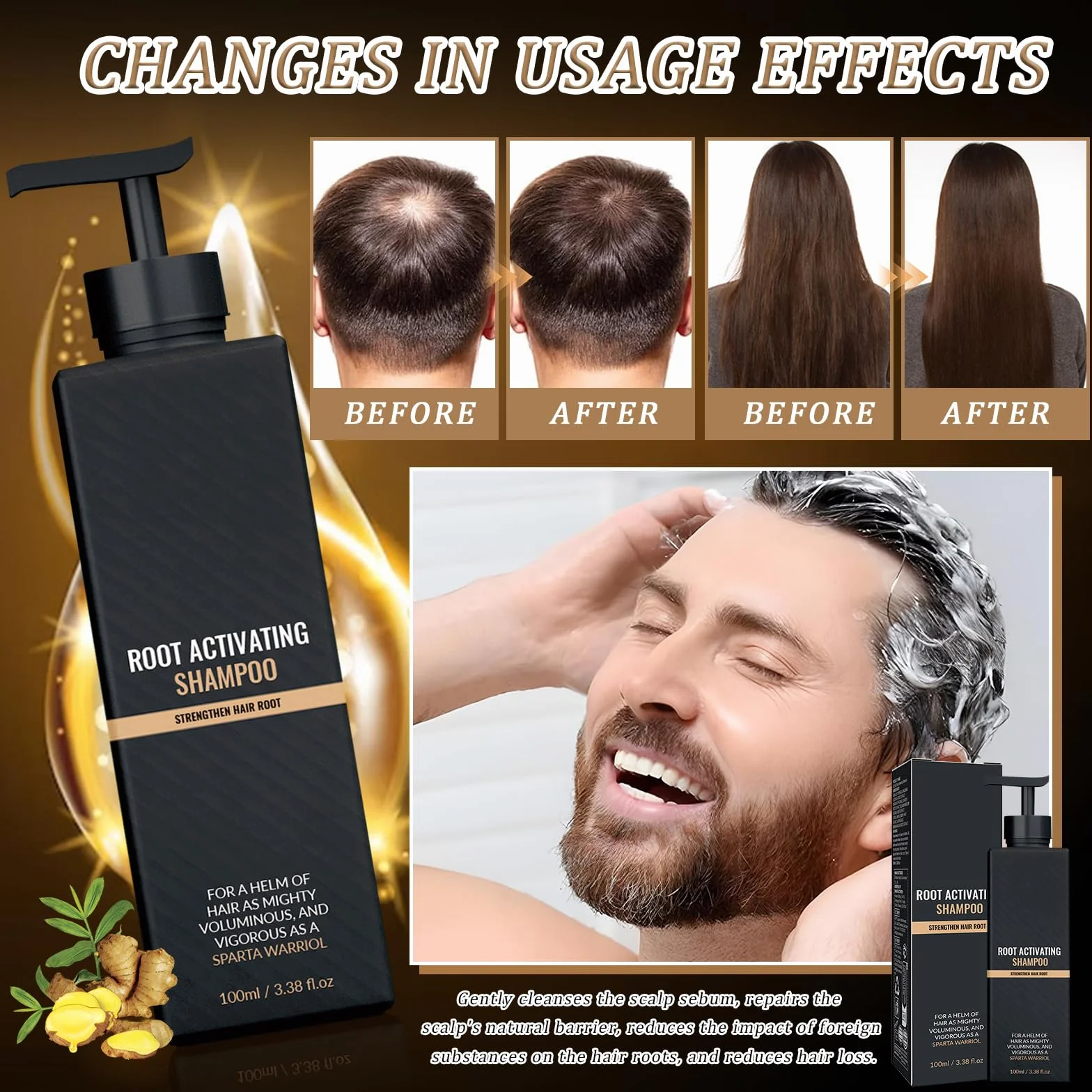 Spart Root Activator Shampoo 2 Piezas Champú Activador de Raíces Ingredientes Botánicos Suaves