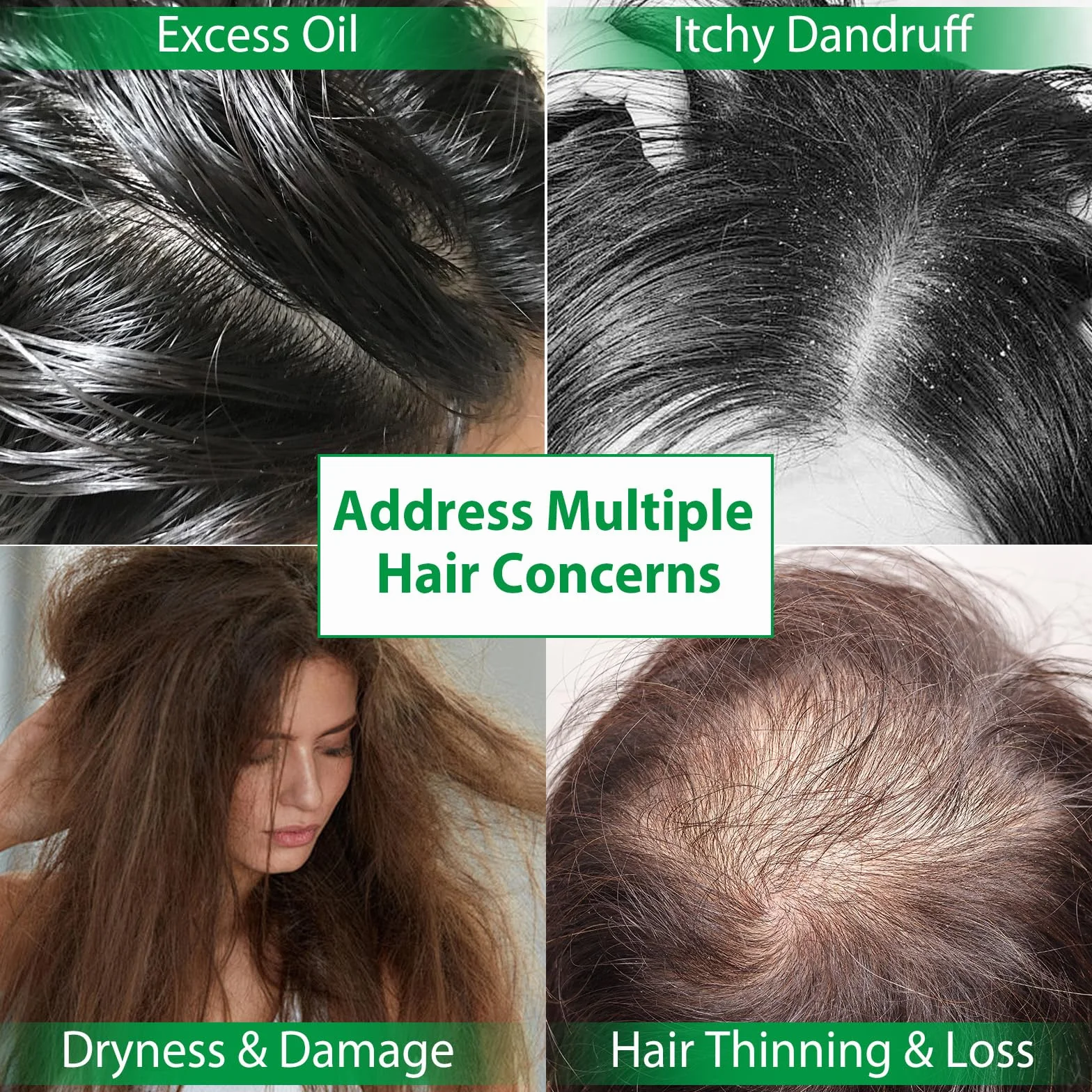 Batana Oil Shampoo und Conditioner Set, Clarificante Haarwachstumskur für dünendes Haar