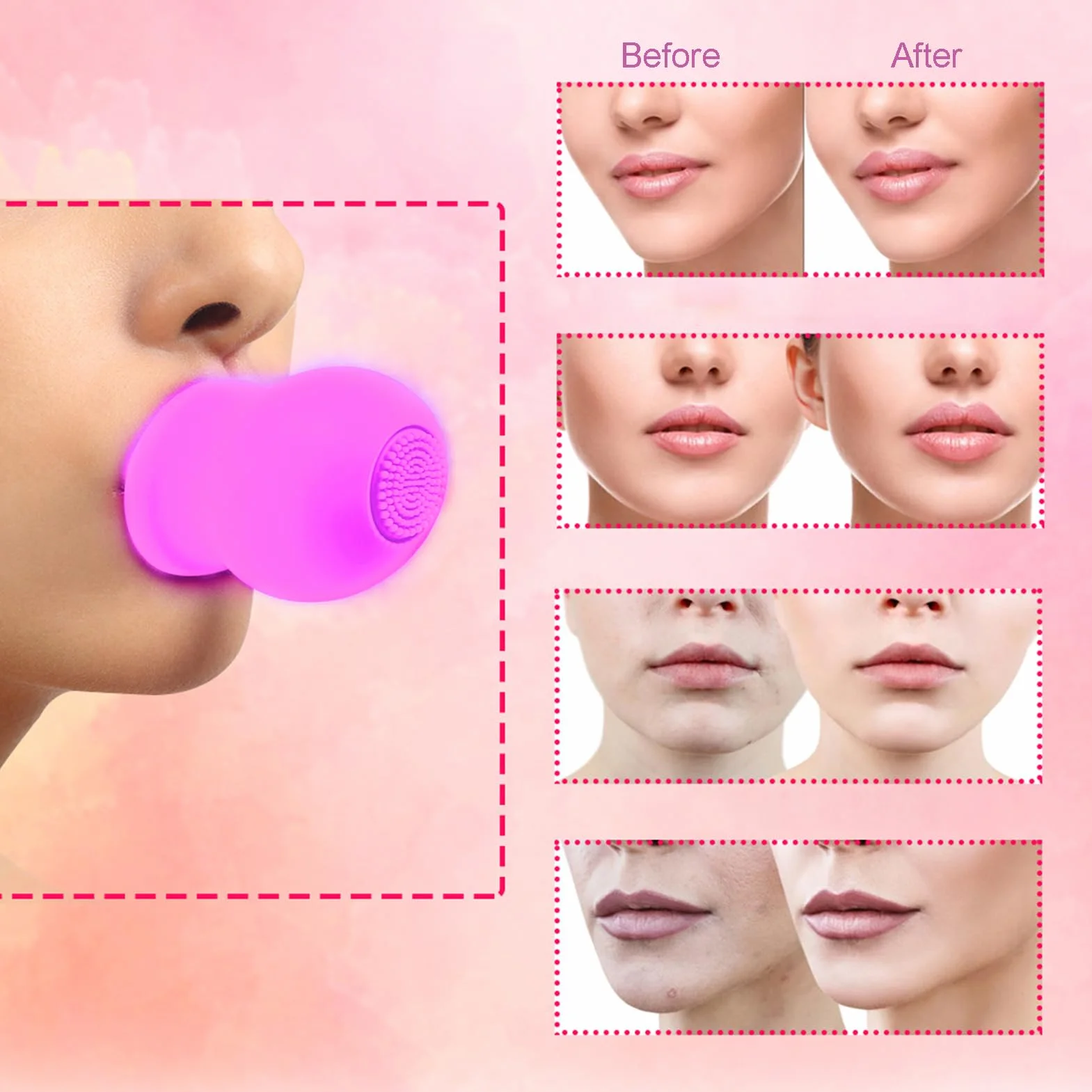 Bomba de Labios de Silicona 2 Colores para Masaje Facial con Cepillo