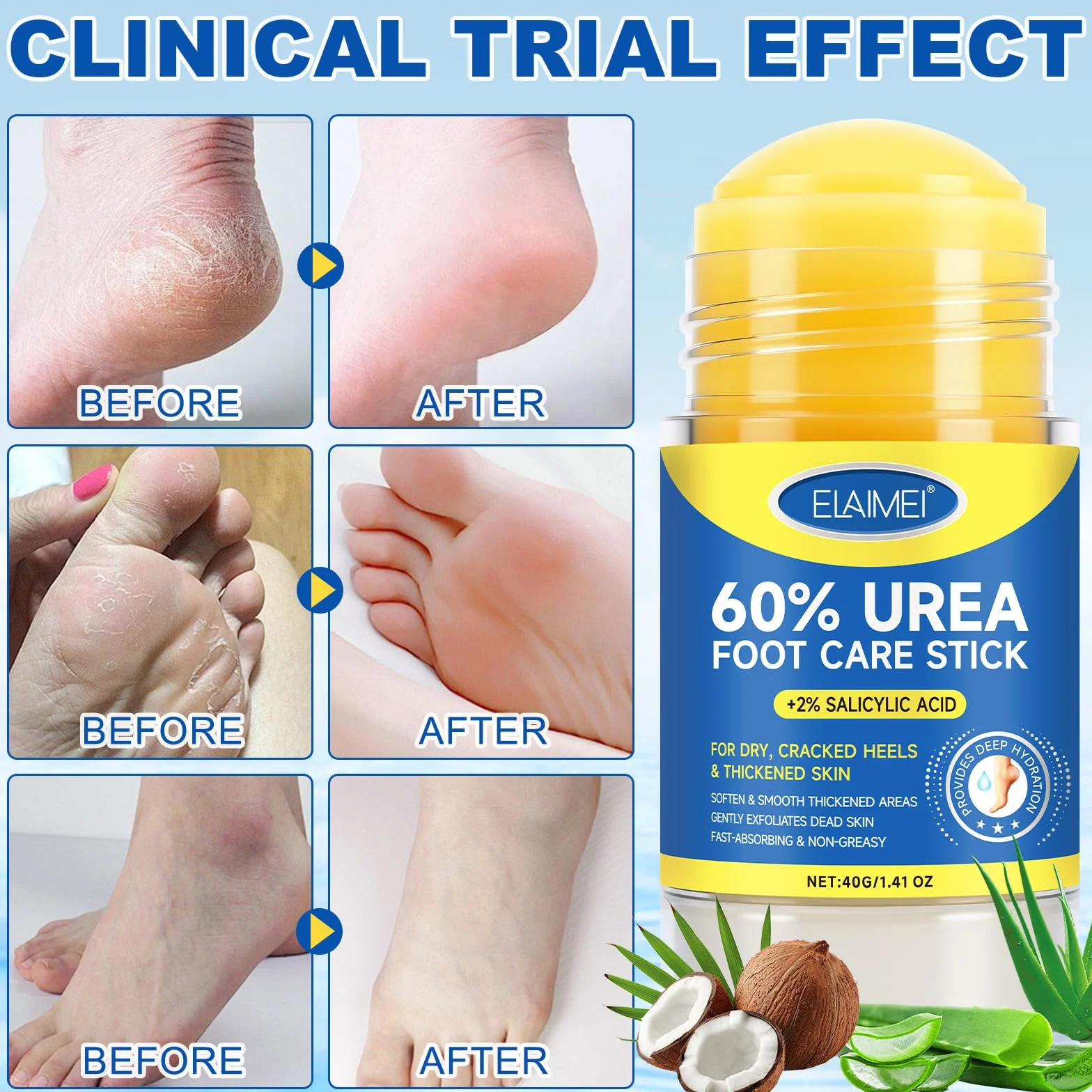 Krem Stick z Mocznikiem 60% i Kwasem Salicylowym 2% na Popękane Pięty i Suche Stopy 40g