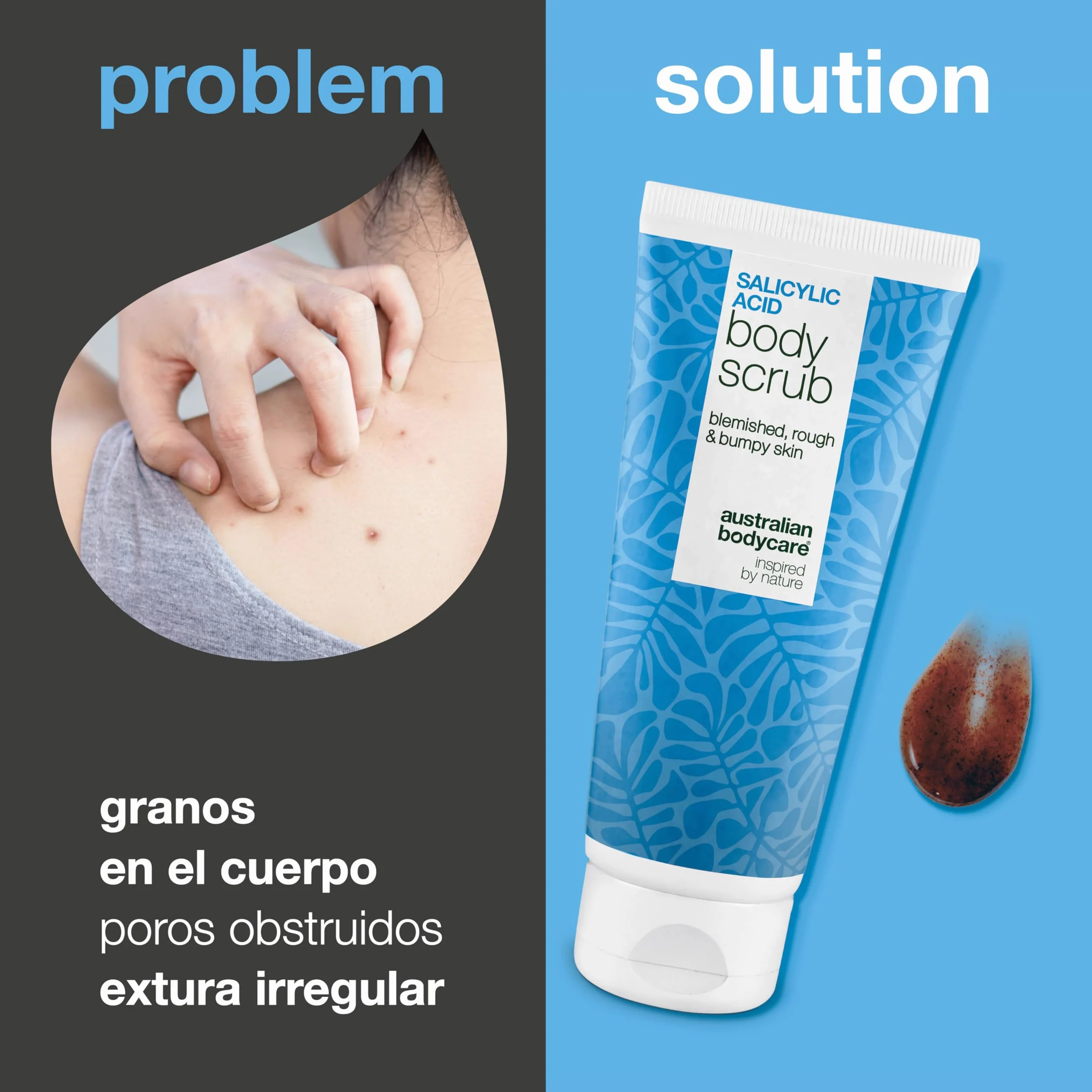 Exfoliante corporal ácido salicílico glicólico BHA AHA para granos espinillas puntos negros